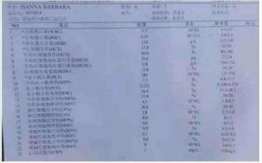 中国著名针灸专家 治疗肿瘤第一人——陈吉香