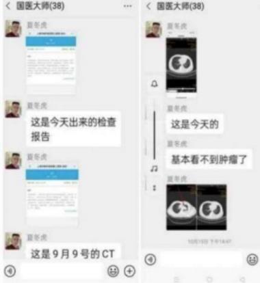 中国著名针灸专家 治疗肿瘤第一人——陈吉香