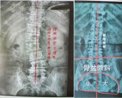 贯彻落实两会精神  访新时代国医名师---杨宗仙