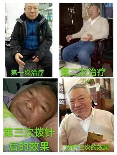 中医传国脉  岐伯济天下  访中国中医专家委员会副委员长-潘玲莉