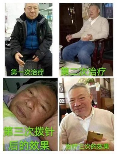 中医传国脉  岐伯 济天下  访中国中医专家委员会副委员长-潘玲莉